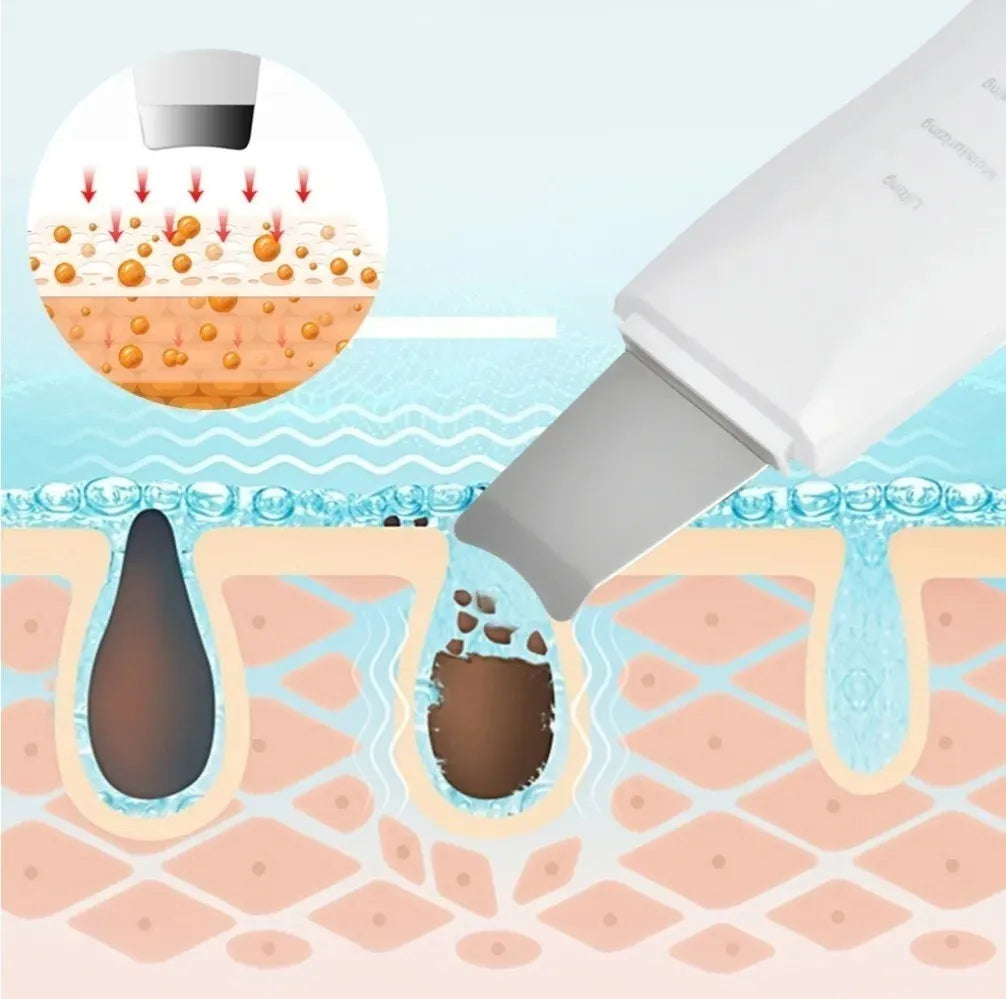 Espátula Facial Ultrasonica✨- Limpieza Profunda - Elimina impurezas y células muertas en minutos, dejando tu piel fresca y renovada.